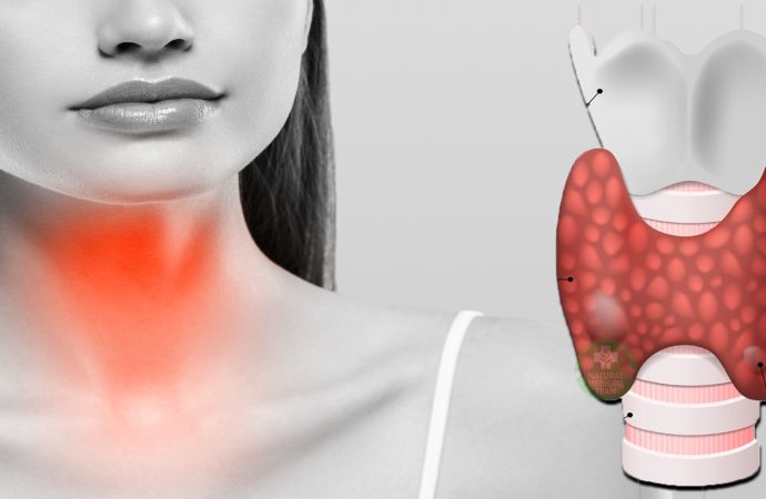 Understanding Underactive Thyroid: Causes, Symptoms, and Treatment