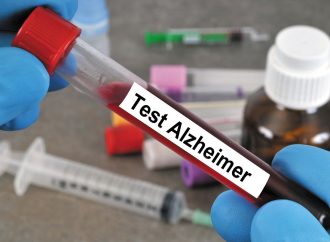 Which Blood Test Required for Early Alzheimer’s Detection