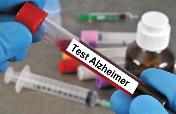 Which Blood Test Required for Early Alzheimer’s Detection