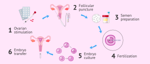 Assisted Reproductive Technology