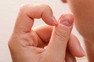 White Spots on Nails