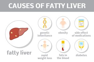 Fatty Liver