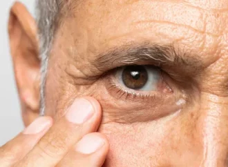 Age-Related Eye Issues: Understanding Managing the Top Four