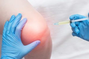 Knee Arthritis Shot