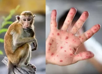 Monkeypox and Children: Key Facts and Precautions for Parents