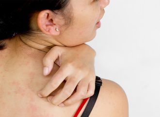 When a Rash Is More Than Just a Rash: What to Look Out For