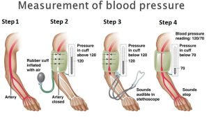 Blood Pressure Checks