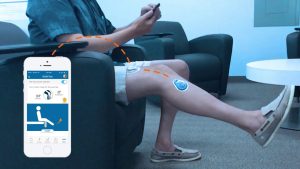 How Wearable Technology is Revolutionizing Healthcare