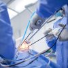 Minimally Invasive Procedures: A Revolution in Surgical Care