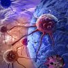 Innovations in Cancer Treatment 2025: New Breakthroughs