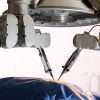 How Advances in Robotics Are Improving Surgery