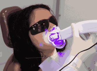 Charcoal vs. Blue Light Whitening: What’s Safer for Your Enamel?
