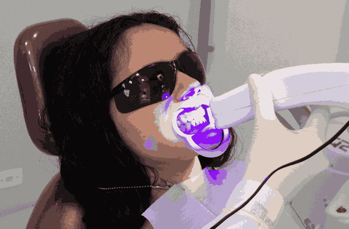 Charcoal vs. Blue Light Whitening: What’s Safer for Your Enamel?