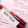 HIV Testing: Essential Guide to Safe and Accurate Screening