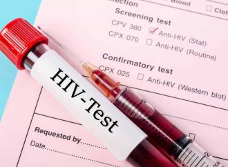 HIV Testing: Essential Guide to Safe and Accurate Screening