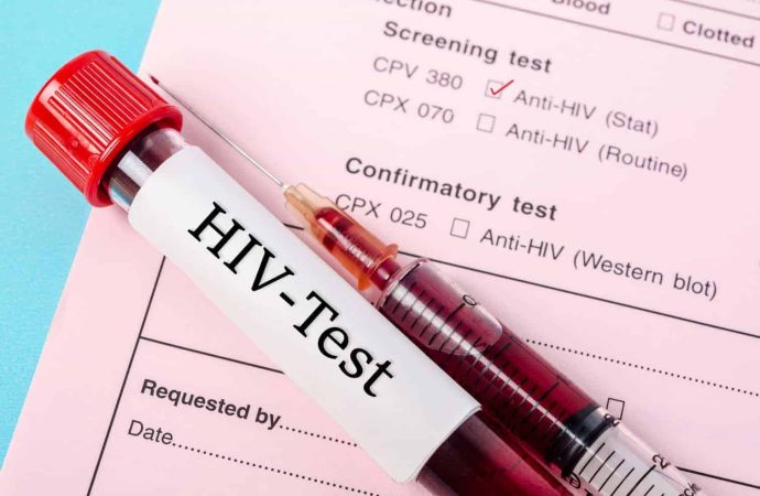 HIV Testing: Essential Guide to Safe and Accurate Screening