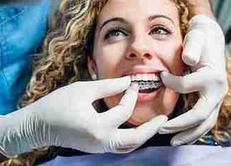 Straightening Smiles with Confidence and Care in Glasgow