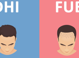 FUE vs FUT: Which Hair Transplant Clinic Offers the Best Method?