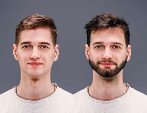 Beard Implant Care