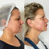 Among the Best Aesthetic Clinics in Dubai for Natural Results