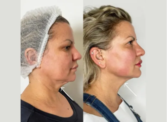 Among the Best Aesthetic Clinics in Dubai for Natural Results
