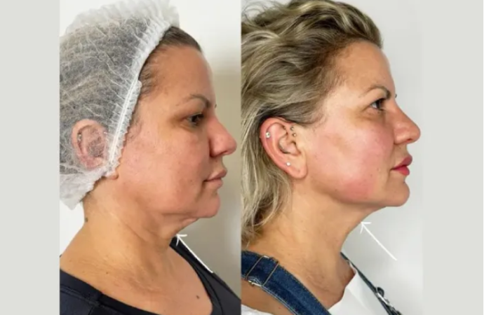 Among the Best Aesthetic Clinics in Dubai for Natural Results