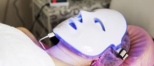 UV Light Therapy Vitiligo Treatment