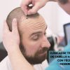 Affordable Hair Transplant Clinics with Modern Techniques