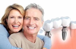 Dental Implants Market