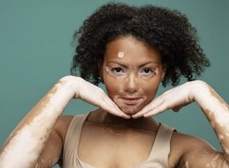 Herbal Supplements That May Help Repigment Vitiligo Patches