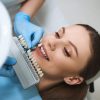 Discover the Power of Veneers at Northlane Dental