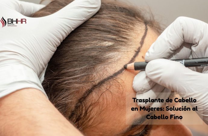 Hair Transplant for Women: A Solution for Thin Hair