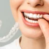Effortless and Subtle Teeth Alignment Options