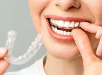 Effortless and Subtle Teeth Alignment Options