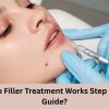How Lip Filler Treatment Works Step by Step Guide?