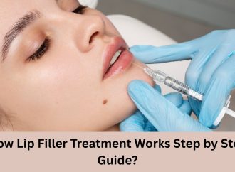 How Lip Filler Treatment Works Step by Step Guide?