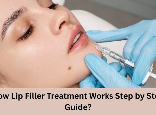 How Lip Filler Treatment Works Step by Step Guide?