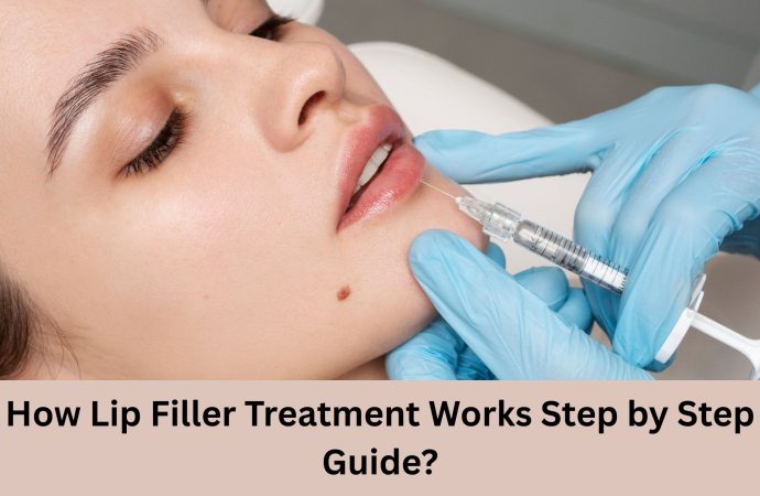 How Lip Filler Treatment Works Step by Step Guide?