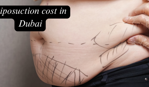 Liposuction Cost in Dubai: Complete Guide