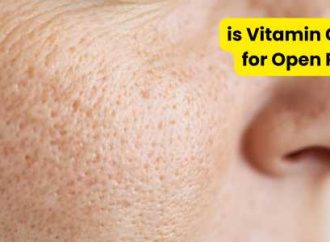 Is Vitamin C Good for Open Pores?