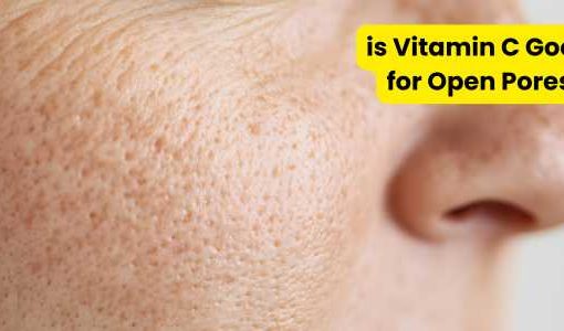 Is Vitamin C Good for Open Pores?