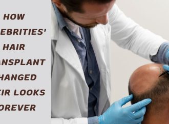 How Celebrities’ Hair Transplant Changed Their Looks Forever