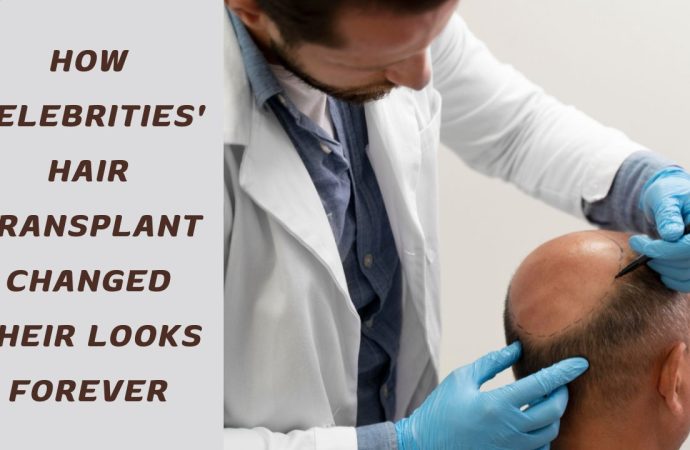 How Celebrities’ Hair Transplant Changed Their Looks Forever
