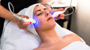 Vampire Facial Treatment in Bangalore at Kezaclinic