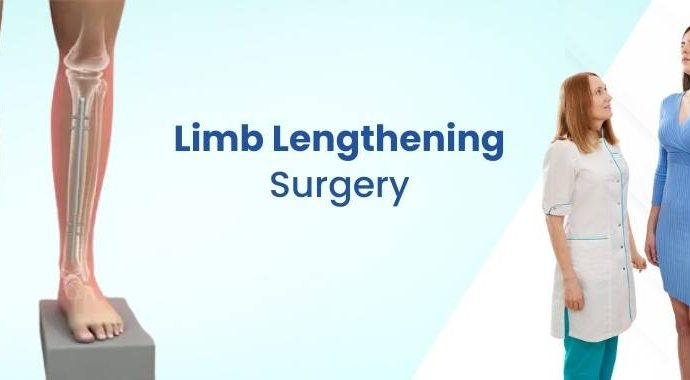 How Limb Lengthening Surgery Can Help Improve Height and Confidence