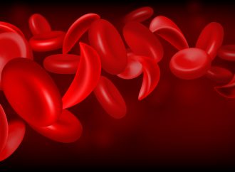 Top Modern Therapies Transforming Sickle Cell Anemia Care