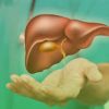 Liver Cancer: Symptoms, Causes, Risk Factors & Treatment