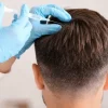 Non-Surgical Hair Replacement: A Natural Hair Loss Solution