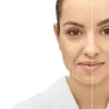 How to Choose the Best Anti-Aging Treatment in Garden City