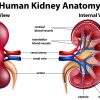 APOL1, C1q Nephropathy & C3 Glomerulopathy Treatment Guide
